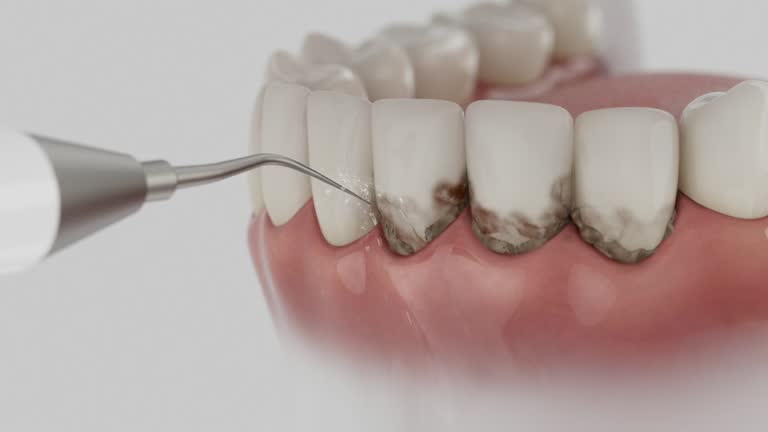 Reliable Emergency Dentist contractor in Cedar Point, NC by Smile Center Dentistry